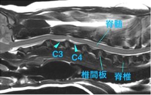 【MR画像、頚部矢状断像、T2強調画像】