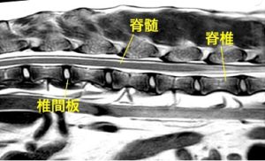 【MR画像、胸腰部矢状断像、正常例】