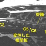 【MR画像、矢状断像】