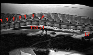 【MRI、胸腰部矢状断像、造影T1強調画像】