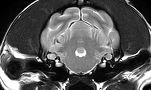 【MRI、中耳内耳レベル横断像、T2強調画像】