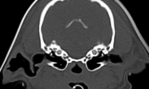 【CT、中耳内耳レベル横断像、骨条件】