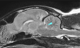 【MRI、矢状断像、T2強調画像】