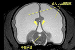 【MRI、病変部の横断像】
