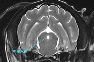 【MRI、横断像（正常）、T2強調画像】