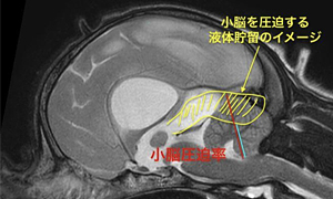 【MRI、矢状断像、T2強調画像】