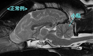 【MRI、矢状断像（正常例）、T2強調画像】