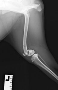 【術前レントゲン】