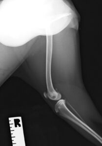 【術前レントゲン】