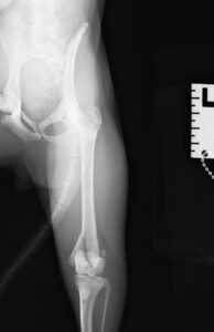 【術前レントゲン】