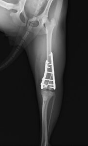 【術後レントゲン】