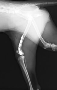 【術後レントゲン】