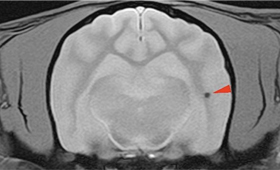 【MRI、横断像、T2*強調画像】