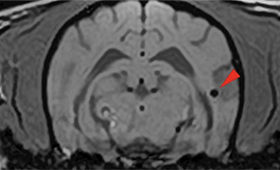 【MRI、横断像、SWI】