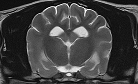 【MRI、横断像、T2強調画像】