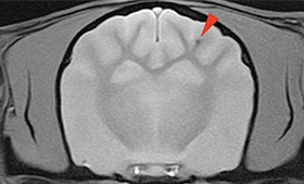 【MRI、横断像、T2*強調画像】