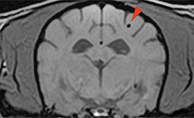 【MRI、横断像、SWI】