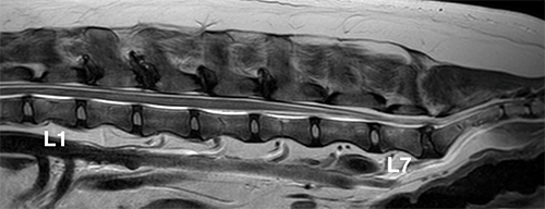 【MRI、矢状断像、T2強調画像】