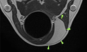 【MRI、横断像、T1強調画像】