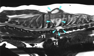 【MRI、矢状断像、T2強調画像】