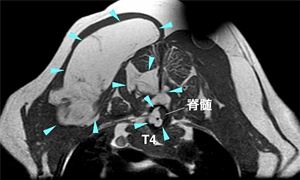 【MRI、横断像、T1強調画像】