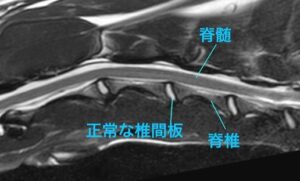 <MR画像 矢状断像 正常例>