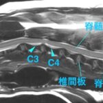 [MR画像 頚部矢状断像 T2強調画像]