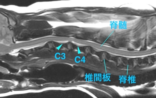 [MR画像 頚部矢状断像 T2強調画像]