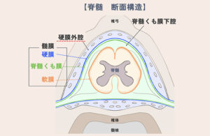 硬膜外出血とは