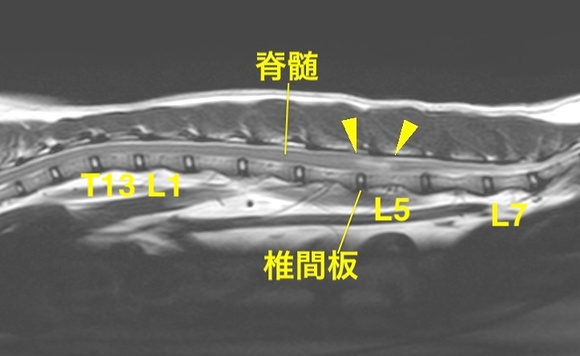[腰部矢状断像T2強調画像]