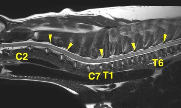 [頚胸部矢状断像 T2強調画像]
