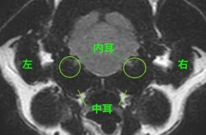 【正常の画像】