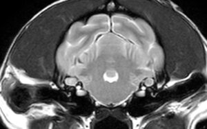 【MRI、内耳／中耳レベル画像】