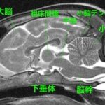 【MRI、矢状診断、T2強調画像】