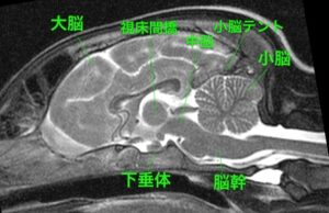【MRI、矢状診断、T2強調画像】