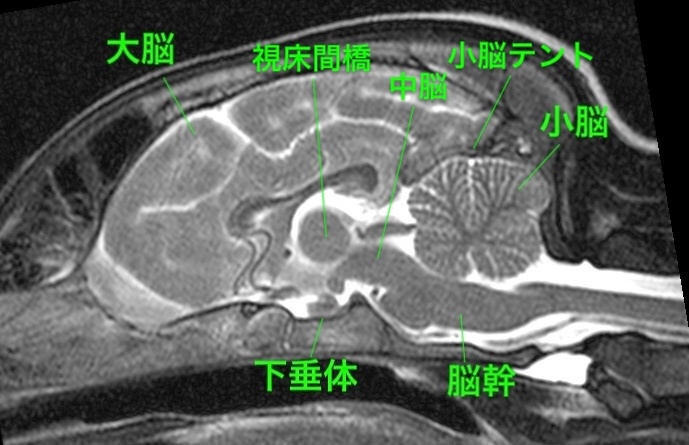 【MRI、矢状診断、T2強調画像】