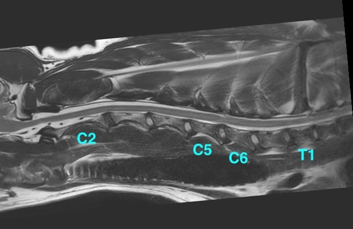 [MR画像 矢状断像 T2強調画像]