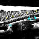 [胸部矢状断像、T2強調画像]
