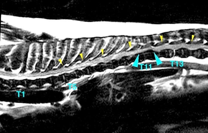 [胸部矢状断像、T2強調画像]
