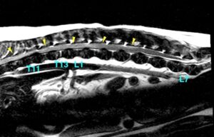 [腰部矢状断像、T2強調画像]