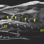 【MRI、頚部矢状断像、T2強調画像】
