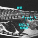 【MRI、矢状断像、胸腰部】