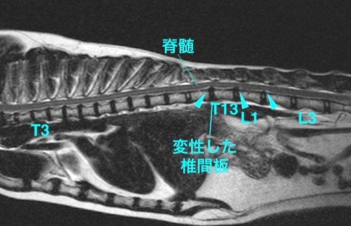 【MRI、矢状断像、胸腰部】