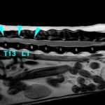 【胸部矢状断像 T2強調画像】