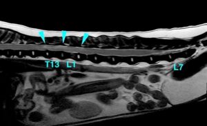 【胸部矢状断像 T2強調画像】