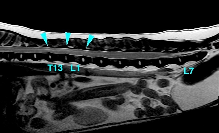 【胸部矢状断像 T2強調画像】