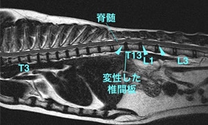 【MRI、矢状断像、胸腰部】