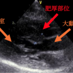 ⼼臓超⾳波検査結果