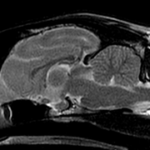 【MRI、矢状断像、T2強調画像】