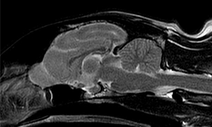 【MRI、矢状断像、T2強調画像】